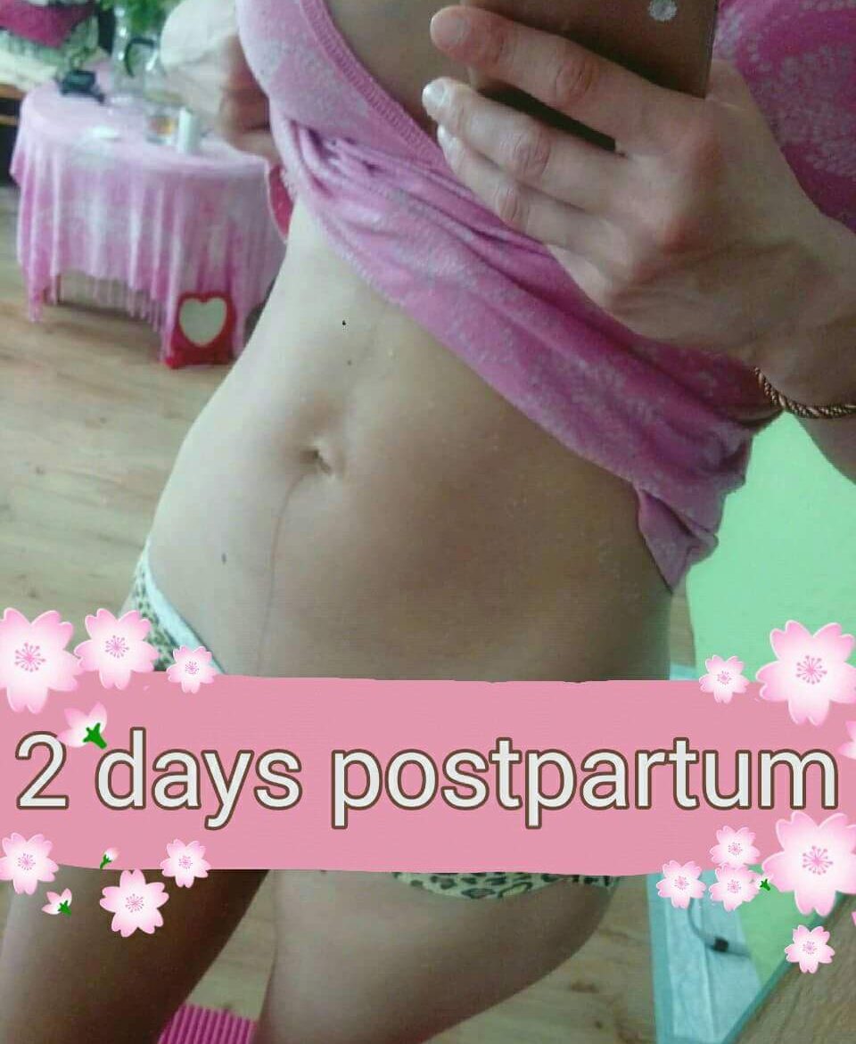 2 päeva pärast sünnitamist